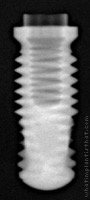 Radiograph of Titamax T I Medular