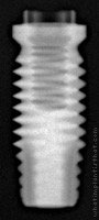 Radiograph of Titamax TI Cortical