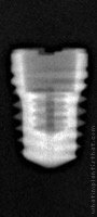 Radiograph of Titamax WS Cortical