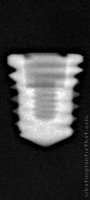 Radiograph of Titamax WS Cortical