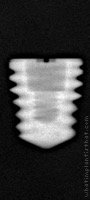 Radiograph of Titamax WS Cortical