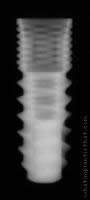 Radiograph of TRU (NP)