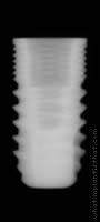 Radiograph of TRU (RP)