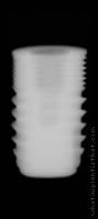 Radiograph of TRU (RP)