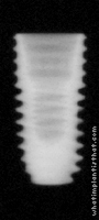 Radiograph of Osstem TSIII
