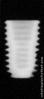 Radiograph of Osstem TSIII