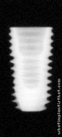 Radiograph of Osstem TSIII