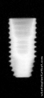 Radiograph of Osstem TSII