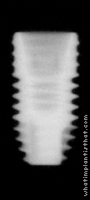 Radiograph of Osstem TSII