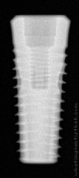 Radiograph of Implance | TWFHR5512