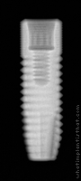 Radiograph of Astra Tech TX
