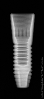 Radiograph of Astra Tech TX