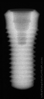 Radiograph of Tapered Effect WN
