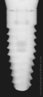 Radiograph of Tapered Internal RBT, Laser-Lok