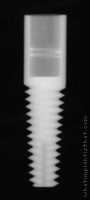 Radiograph of Tapered Root Form