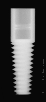 Radiograph of Tapered Root Form