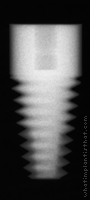 Radiograph of Tapered Root Form