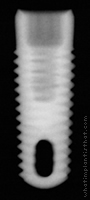 Radiograph of Tapered Screw-Vent