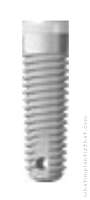 Radiograph of Tapered Standard