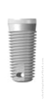 Radiograph of Tapered XL