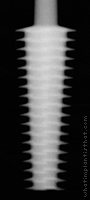 Radiograph of Titanodont