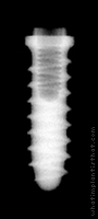 Radiograph of Tixos Cylinder