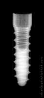 Radiograph of Tixos