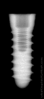 Radiograph of Tixos