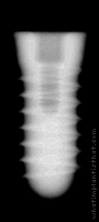 Radiograph of Tixos
