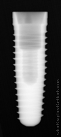 Radiograph of Tri-Lobe