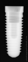 Radiograph of Tri-Lobe