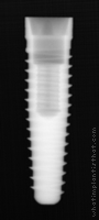 Radiograph of Tri-Lobe