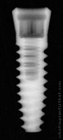 Radiograph of Two-Piece Taper Screw (TSI)