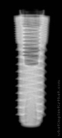 Radiograph of Uneva+