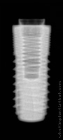Radiograph of Uneva+