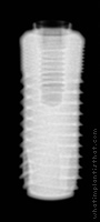 Radiograph of Uneva+