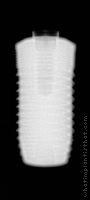 Radiograph of Uneva+