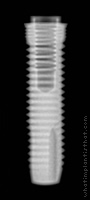 Radiograph of Universal+