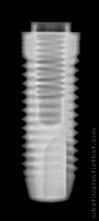 Radiograph of Universal+