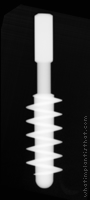 Radiograph of Wide