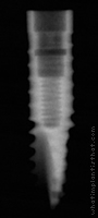 Radiograph of Friadent XiVE S