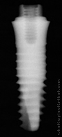 Radiograph of Friadent XiVE TG