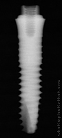 Radiograph of Friadent XiVE TG