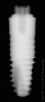 Radiograph of Friadent XiVE TG Plus
