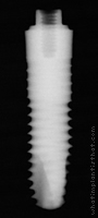 Radiograph of Friadent XiVE TG Plus