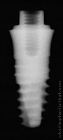 Radiograph of Friadent XiVE TG