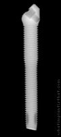 Radiograph of Zigomatico CM