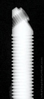 Radiograph of Zygomatic