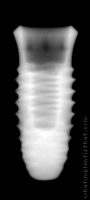 Radiograph of INNO Internal