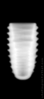 Radiograph of INNO Submerged